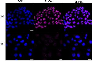 Immunocytochemical staining of HT- cells using RHOA antibody (ABIN7800142), 1:1,000), Top panel: wild-type (WT), Bottom panal: RHOA shRNA knockdown (KD).