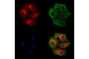 ABIN6256297 and ABIN6267410 staining Hela cells(4h of LPS treatment) by IF/ICC. (Connexin 43/GJA1 antibody  (pSer368))