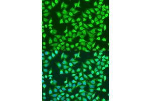 Immunofluorescence analysis of U2OS cells using SIRT4 antibody (ABIN7270326) at dilution of 1:100. (SIRT4 antibody  (AA 1-200))