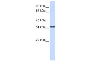 NANOS1 antibody used at 1 ug/ml to detect target protein.