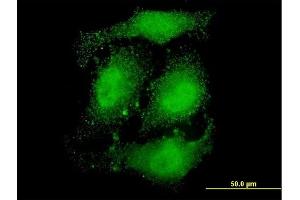 Immunofluorescence of monoclonal antibody to ATN1 on HeLa cell. (Atrophin 1 antibody  (AA 1-110))