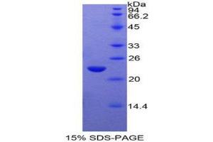 SDS-PAGE (SDS) image for Glucosidase, Alpha, Acid (GAA) (AA 782-953) protein (His tag) (ABIN2124972)