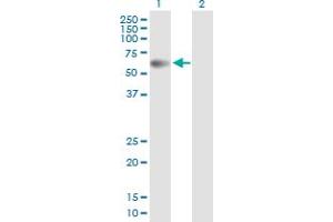 Western Blot analysis of PPM1B expression in transfected 293T cell line by PPM1B MaxPab polyclonal antibody. (PPM1B antibody  (AA 1-479))