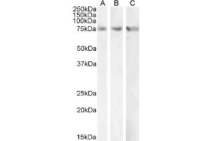 CPT2 antibody  (AA 141-154)
