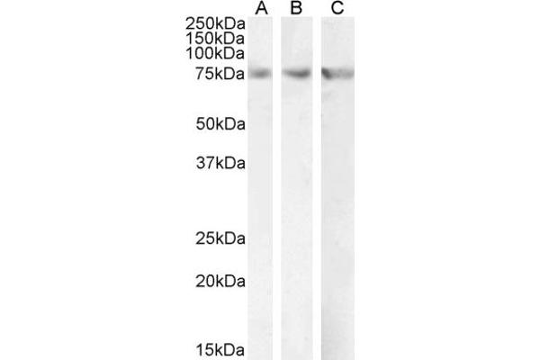 CPT2 antibody  (AA 141-154)