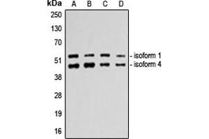 Western blot analysis of p53 expression in A549 (A), HeLa (B), MDAMB231 (C), HepG2 (D) whole cell lysates. (p53 antibody  (C-Term))