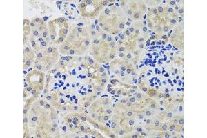 Immunohistochemistry of paraffin-embedded Mouse kidney using HK3 Polyclonal Antibody at dilution of 1:100 (40x lens). (HK3 antibody)