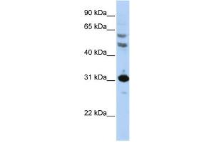 WB Suggested Anti-HOXB5 Antibody Titration: 0.