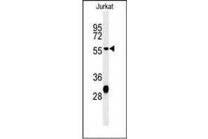 Western Blotting (WB) image for anti-Hydroxyacyl-CoA Dehydrogenase/3-Ketoacyl-CoA Thiolase/enoyl-CoA Hydratase (Trifunctional Protein), beta Subunit (HADHB) (AA 321-351), (C-Term) antibody (ABIN952676)