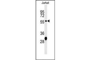 Western blot analysis of HADHB Antibody (C-term) in Jurkat cell line lysates (35ug/lane).