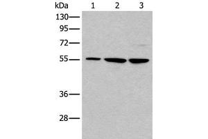 Western blot analysis of 293T and A172 cell lysates using TRIM27 Polyclonal Antibody at dilution of 1:600 (TRIM27 antibody)