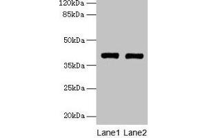 Western blot All lanes: MAB21L1 antibody at 6 μg/mL Lane 1: A375 whole cell lysate Lane 2: CEM whole cell lysate Secondary Goat polyclonal to rabbit IgG at 1/10000 dilution Predicted band size: 41 kDa Observed band size: 41 kDa (MAB21L1 antibody  (AA 1-359))