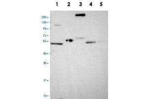 Western blot analysis of Lane 1: RT-4, Lane 2: U-251 MG, Lane 3: Human Plasma, Lane 4: Liver, Lane 5: Tonsil with COL17A1 polyclonal antibody . (COL17A1 antibody)