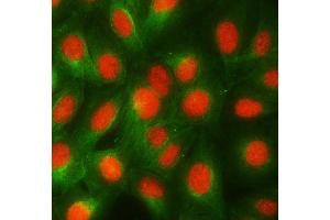 IF analysis of RBMY1A1 and Tubulin beta using anti-RBMY1A1 antibody (ABIN7600392) and anti-Tubulin beta antibody (ABIN7602744).