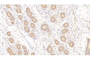 Detection of PTPRM in Human Uterus Tissue using Polyclonal Antibody to Protein Tyrosine Phosphatase Receptor Type M (PTPRM) (PTPRM antibody  (AA 1197-1403))