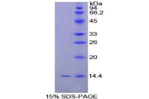 SDS-PAGE (SDS) image for Inhibin, beta B (INHBB) (AA 277-391) protein (His tag) (ABIN1079930) (INHBB Protein (AA 277-391) (His tag))