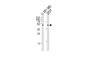 Western blot analysis of lysates from U-251 MG, 293T cell line (from left to right), using C Antibody (Center) (ABIN655405 and ABIN2844951).