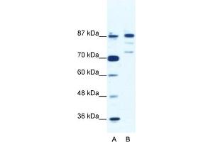 WB Suggested Anti-BACH1 Antibody Titration:  1. (BACH1 antibody  (C-Term))