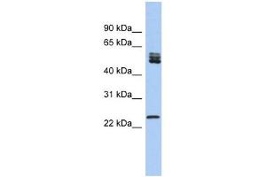 SFRS7 antibody used at 1 ug/ml to detect target protein. (SFRS7 antibody  (N-Term))