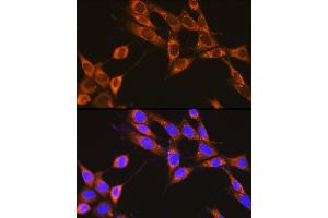Immunofluorescence analysis of NIH-3T3 cells using PKM1-specific Rabbit pAb (ABIN7269383) at dilution of 1:100 (40x lens). (PKM1-Specific antibody)