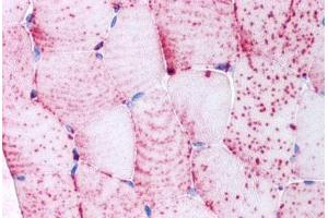 Human Skeletal Muscle, Myocytes (formalin-fixed, paraffin-embedded) stained with TNIK antibody ABIN213549 at 5 ug/ml followed by biotinylated goat anti-rabbit IgG secondary antibody ABIN481713, alkaline phosphatase-streptavidin and chromogen. (TNIK antibody  (Internal Region))