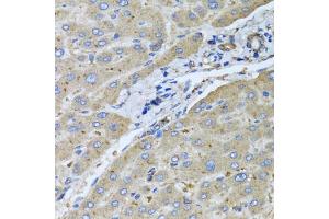 Immunohistochemistry of paraffin-embedded human liver injury using μgT2B10 antibody (ABIN5975607) at dilution of 1/100 (40x lens). (UGT2B10 antibody)