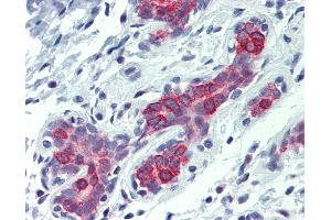 Immunohistochemistry (IHC) image for anti-BCL2-Antagonist/killer 1 (BAK1) (AA 1-14) antibody (ABIN573998)