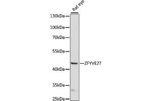 Western blot analysis of extracts of rat eye, using ZFYVE27 antibody (ABIN7271557) at 1000 dilution. (ZFYVE27 antibody  (AA 217-411))