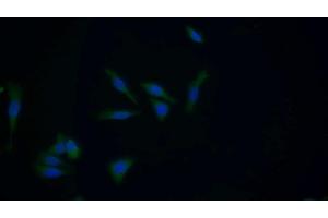 Detection of GSTM1 in Human HepG2 cell using Polyclonal Antibody to Glutathione S Transferase Mu 1 (GSTM1) (GSTM1 antibody  (AA 1-220))