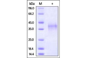 Rabbit PD-1, His Tag on SDS-PAGE under reducing (R) condition.