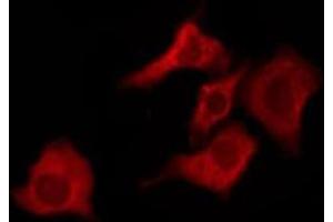 OR10G7 antibody  (C-Term)