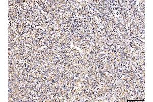 IHC analysis of MT-CO2 using anti-MT-CO2 antibody (ABIN7599081).