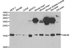 Western blot analysis of extracts of various cell lines, using UBE2B antibody. (UBE2B antibody)