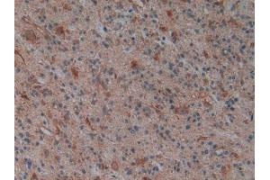 Immunohistochemistry (IHC) image for anti-Placental Alkaline Phosphatase (ALPP) (AA 162-312) antibody (ABIN7432097)