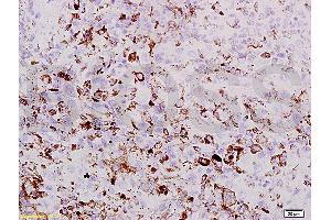 PRAME antibody  (AA 151-250)