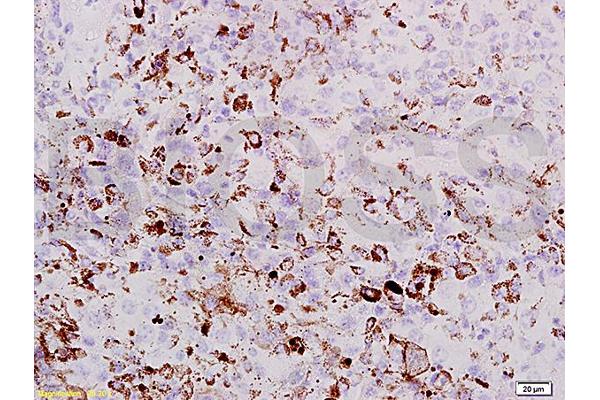 PRAME antibody  (AA 151-250)