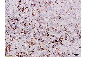 Formalin-fixed and paraffin embedded mouse lung labeled with Rabbit Anti PRAME Polyclonal Antibody, Unconjugated (ABIN721555) at 1:200 followed by conjugation to the secondary antibody and DAB staining (PRAME antibody  (AA 151-250))