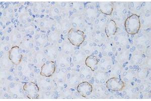 Immunohistochemistry of paraffin-embedded Rat kidney using Aquaporin 4 Polyclonal Antibody at dilution of 1:50 (40x lens). (Aquaporin 4 antibody)