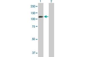 Western Blot analysis of PPP1R13L expression in transfected 293T cell line by PPP1R13L MaxPab polyclonal antibody. (PPP1R13L antibody  (AA 1-828))