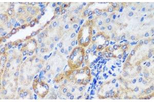 Immunohistochemistry of paraffin-embedded Mouse kidney using ERK1 / ERK2 Polyclonal Antibody at dilution of 1:200 (40x lens). (ERK1/2 antibody)