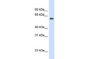 WB Suggested Anti-CAT Antibody Titration: 0. (Catalase antibody  (Middle Region))