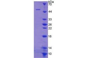 Image no. 1 for Collagen, Type II, alpha 1 (COL2A1) (AA 1259-1449) protein (His tag,GST tag) (ABIN6238185)