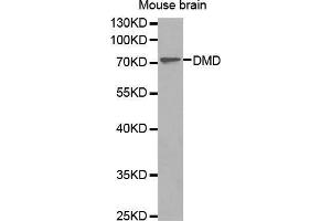 Western Blotting (WB) image for anti-Dystrophin (DMD) (AA 346-635) antibody (ABIN1679546) (Dystrophin antibody  (AA 346-635))