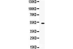 Western blot analysis of FCGRT expression in mouse liver extract (lane 1). (FcRn antibody  (AA 54-291))