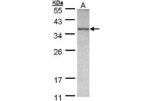 WB Image Sample (30 ug of whole cell lysate) A: A431 , 12% SDS PAGE antibody diluted at 1:500 (OTC antibody)