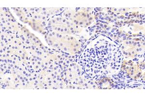 Immunohistochemistry (IHC) image for anti-Epithelial Cell Adhesion Molecule (EPCAM) (AA 25-265) antibody (ABIN7443065)
