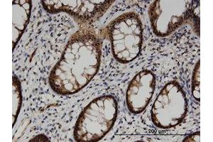 Image no. 1 for anti-Acyl-CoA Thioesterase 7 (ACOT7) (AA 1-339) antibody (ABIN599527) (ACOT7 antibody  (AA 1-339))