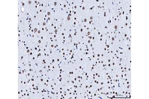 anti-Cleavage and Polyadenylation Specific Factor 6, 68kDa (CPSF6) (AA 50-176) antibody