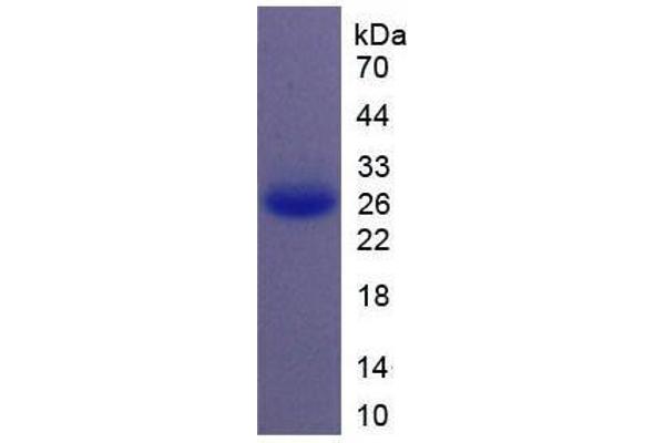 IL-11 Protein (AA 22-199) (His tag)