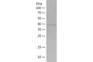 Western Blotting (WB) image for Phosphorylase, Glycogen, Muscle (PYGM) (AA 64-197) protein (His-IF2DI Tag) (ABIN7124447) (PYGM Protein (AA 64-197) (His-IF2DI Tag))